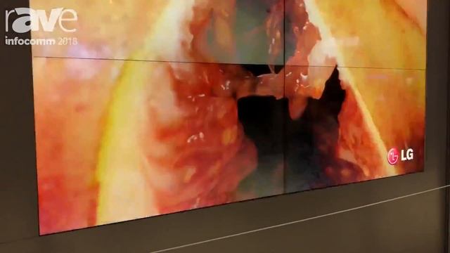 InfoComm 2018: LG Unveils Its 55VH7B 1.2mm Even Bezel Video Wall Display смотреть онлайн