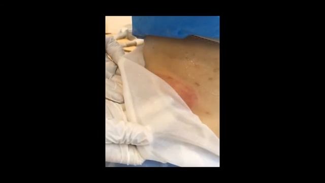 LF-213 Operation for portable cryolipolysis slimming machine смотреть онлайн