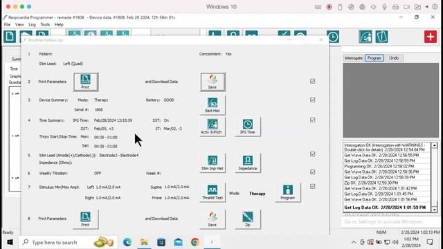 Downloading Data and Saving Parameter Settings - remedē System Model 1001 смотреть онлайн