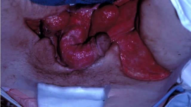 Skin and Soft Tissue Photo Review - John Greene, MD смотреть онлайн