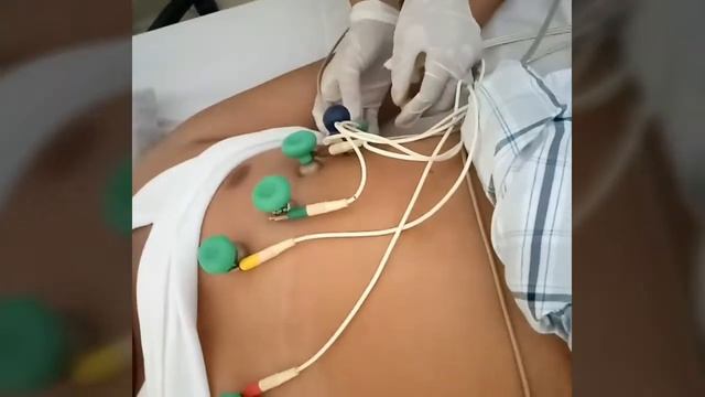CARA MEMASANG ALAT EKG (ALAT PEREKAM JNTUNG) смотреть онлайн