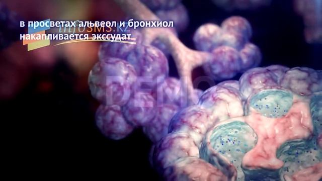 Infosms.kz DemoMedicine смотреть онлайн