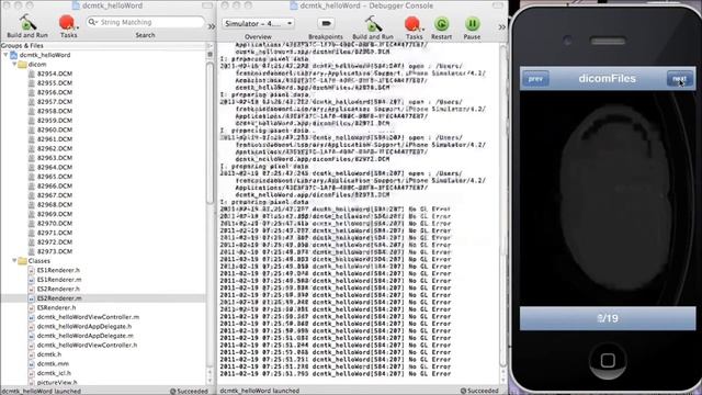 SKULD Project - DCMTK on iPhone - DICOM - EPITECH 2012 смотреть онлайн