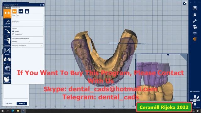 Ceramill Rijeka 2022 смотреть онлайн