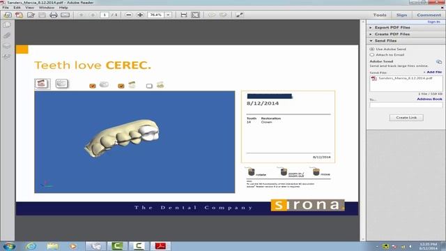Cerec 4.3 and 3D PDF Chinese Version смотреть онлайн