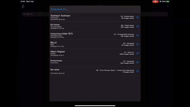 Importing Studies to Horos Mobile™ смотреть онлайн