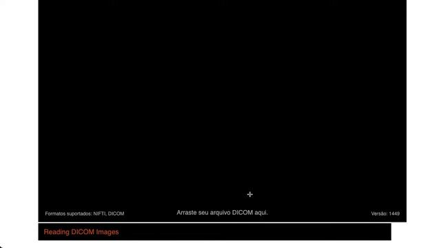 Visualizador Dicom Online Gratuito. - Toprad смотреть онлайн