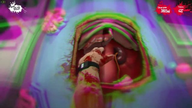 Surgeon simulator. Op #2 смотреть онлайн