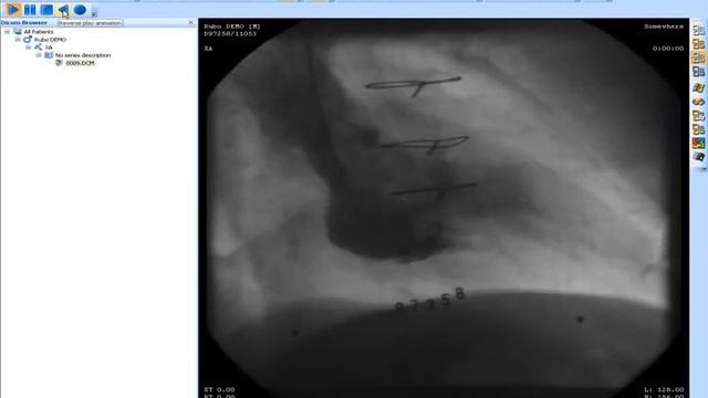 MicroDicom DICOM Viewer 0.0.1 смотреть онлайн