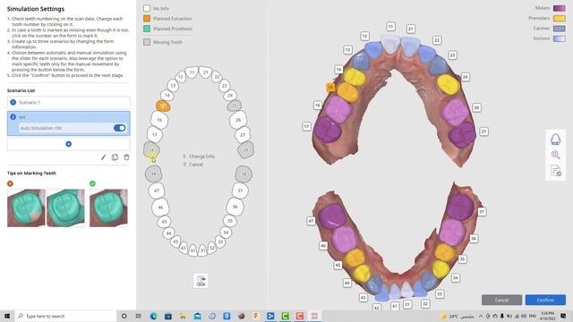 Medit ortho simulation (Arabic tutorial) смотреть онлайн