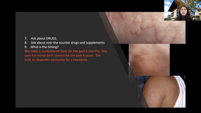 Drug Eruptions: TEN tips to help you adDRESS them смотреть онлайн