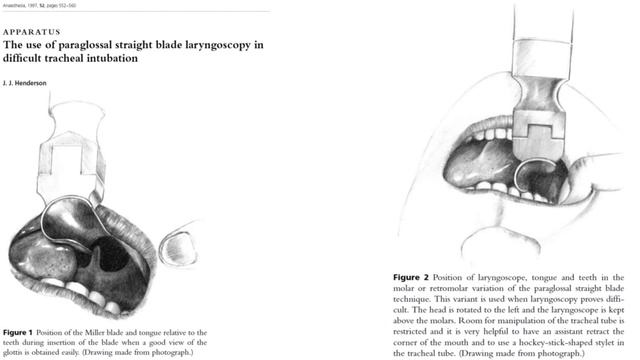 Airway Equipment Part 1 - (Dr. Murphy) смотреть онлайн
