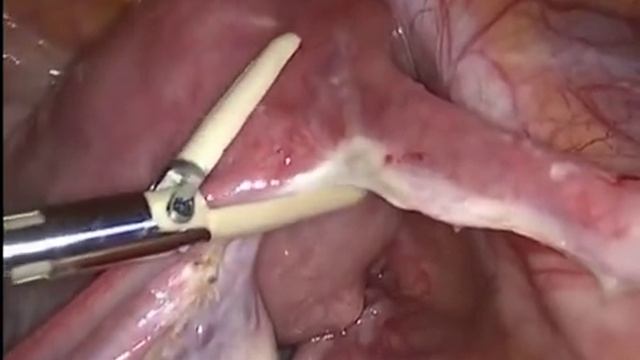 thermocut 5 смотреть онлайн