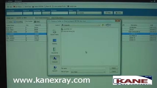 echoes_IMPORT DICOM.avi смотреть онлайн