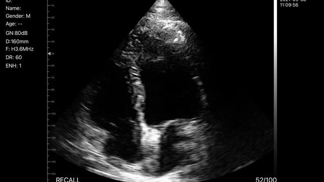BIO-W7 Cardiac Color Doppler Probe смотреть онлайн