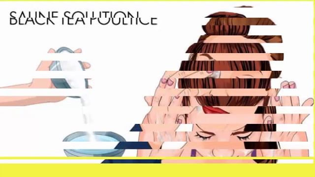 What is Conjunctivitis And How To Cure It Fast-Home Remedies for Allergic Conjunctivitis смотреть онлайн