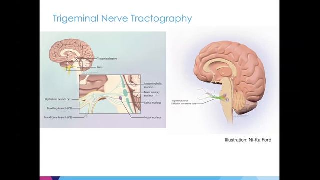 FBI Cyber Series - Visualizing the brain at 7T by Priti Balchandani, PhD смотреть онлайн
