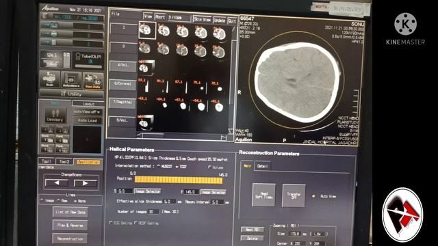 CT Scan karte time Agar ye mistake ho jaye to kya kroge ?@ParveenTechnologist смотреть онлайн