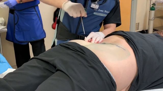 How to Perform Bone Marrow Aspirate Concentrate (BMAC) Harvesting and Stem Cell Injections смотреть онлайн