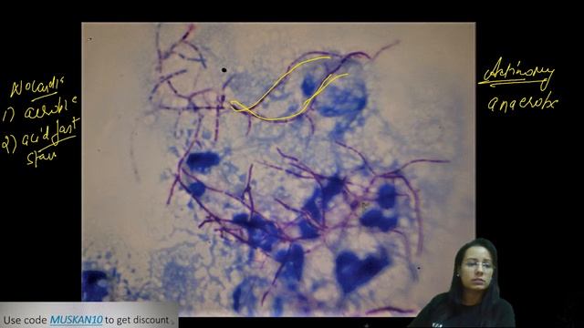 Image Based MCQ 2 | Let's Crack NEET PG | Microbiology | NEET PG'21 | Dr.Muskan Chaudhary смотреть онлайн