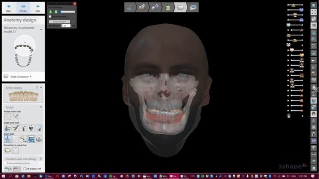Patient Specific Motion and Bellus3D dental pro смотреть онлайн