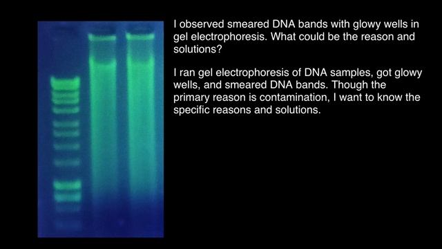 This Is Why Gel Electrophoresis May Get Smeared DNA Bands смотреть онлайн