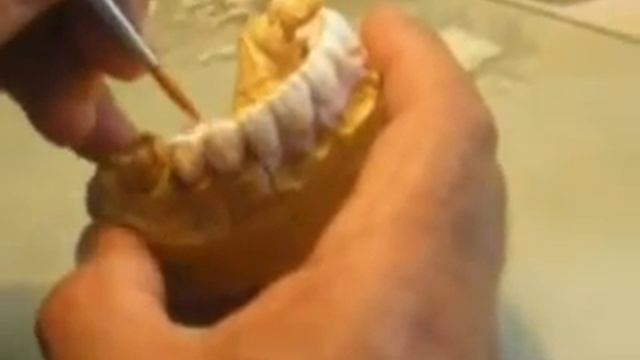 Cerámica Dental-Parte 2 de 5 смотреть онлайн