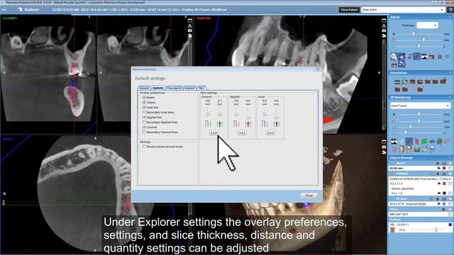New Default Settings Dialog in Planmeca Romexis 4.0 смотреть онлайн