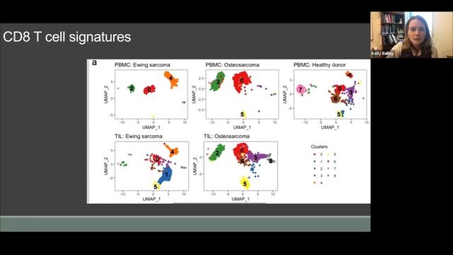 Ewing Sarcoma, Osteosarcoma Have Distinct Immune Signatures and Intercellular Communication Network смотреть онлайн