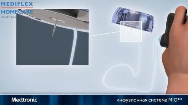 Инфузионный набор Medtronic MiniMed Mio