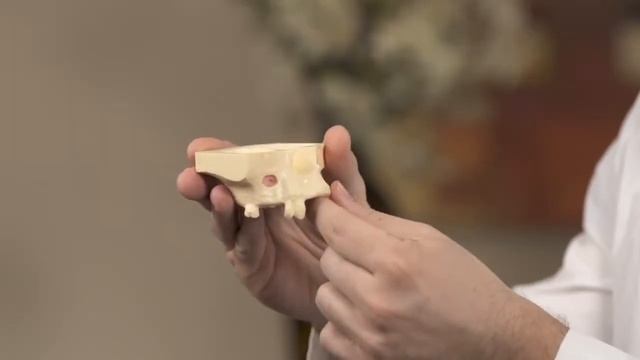Dr. Katranji Discusses the Importance of Sinus Lifts for Dental Implant Placement смотреть онлайн