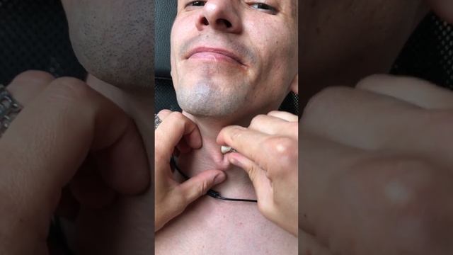 Adam's apple смотреть онлайн