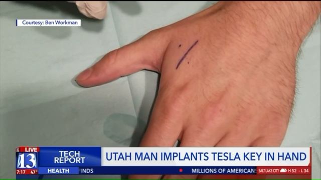 Utah man implants Tesla key in hand смотреть онлайн