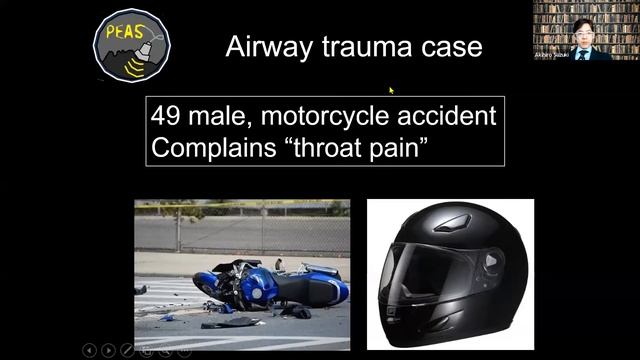 19th Indoanesthesia : Airway Management смотреть онлайн