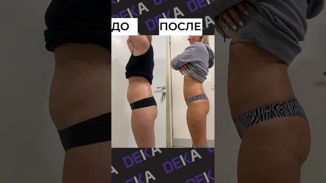 Делимся с вами WOW-результатами нашего партнёра клиники effi на системе Onda смотреть онлайн