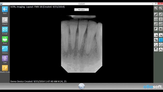 Cliosoft Dental Imaging Software Tutorial: Annotations and filters смотреть онлайн