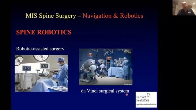 Aplicação de tecnologias da atualidade à cirurgia de coluna minimamente invasiva смотреть онлайн