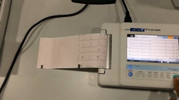 FX8200 FUKUDA ECG Print out
