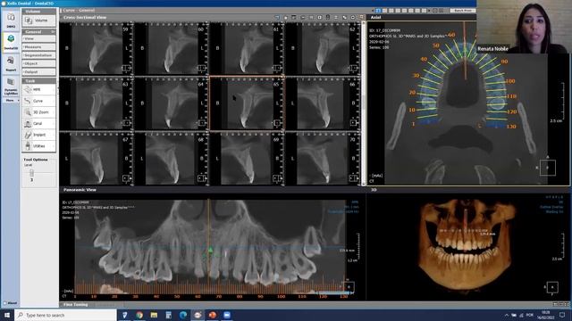 WebClass | Software Xelis Dental смотреть онлайн