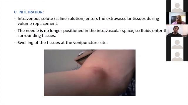T Fusion All about adverse reactions смотреть онлайн