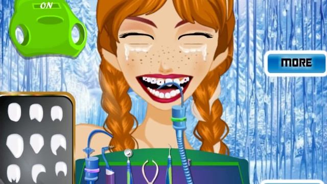 Disney Princess Anna Dentist Game Dental Work Gross