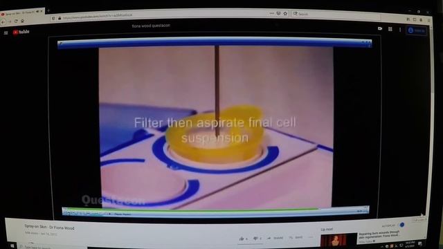 Exhibit 38a and 38b смотреть онлайн