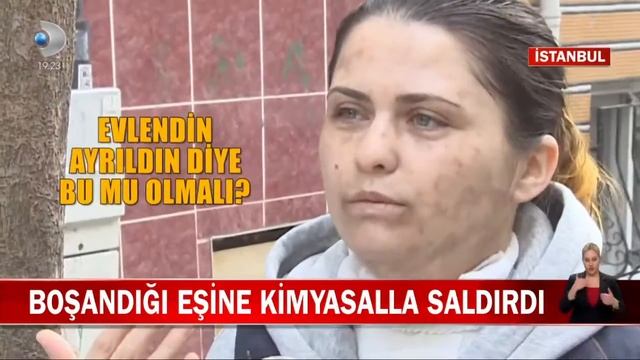 Kanal D Canlı Yayın İzle HD смотреть онлайн
