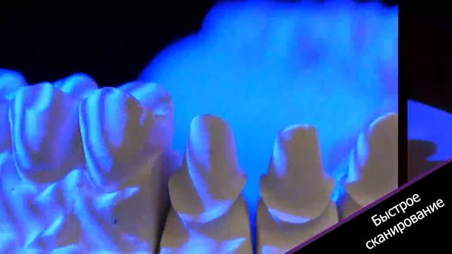 3D-сканер Smart Optics Vinyl UXD смотреть онлайн