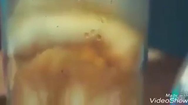 سبحان الله كما يقول المثل: الصحة 👑فوق الرأوس смотреть онлайн