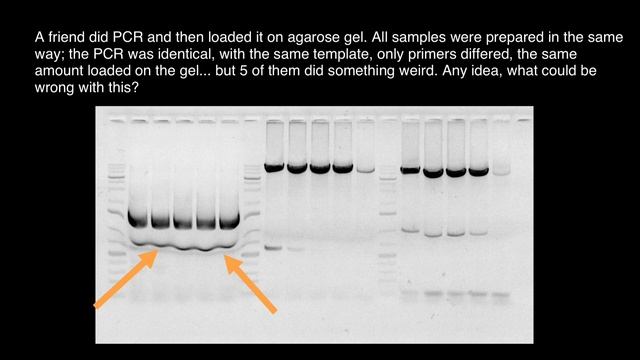 Gel Electrophoresis troubleshooting смотреть онлайн