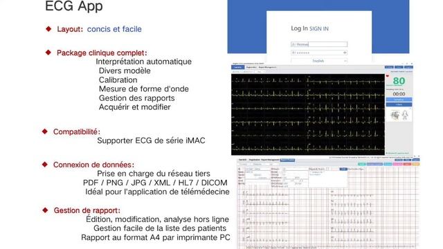 iMac 10 PAD ECG смотреть онлайн