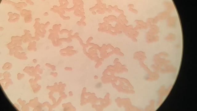 Blood after eating apples. Microscope test смотреть онлайн