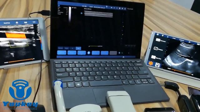 Latest software based Small portable wireless multi probe Ultrasound смотреть онлайн
