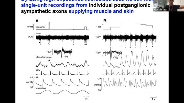 Vaughan Macefield: Microneurography - An introduction, overview and example of recordings смотреть онлайн